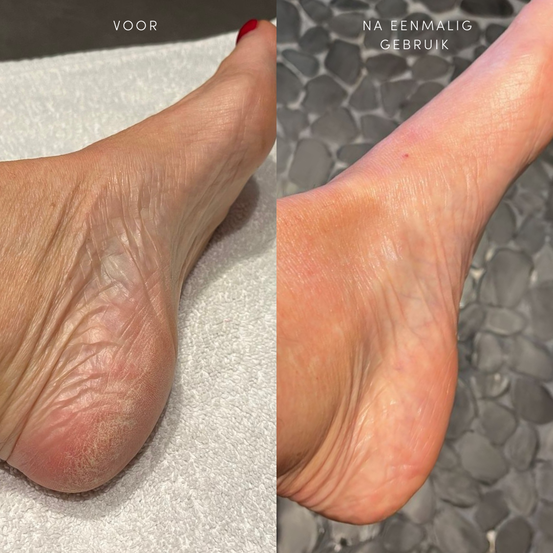 PoshPeel PediCure